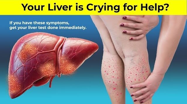 Your Liver Is Crying For Help?